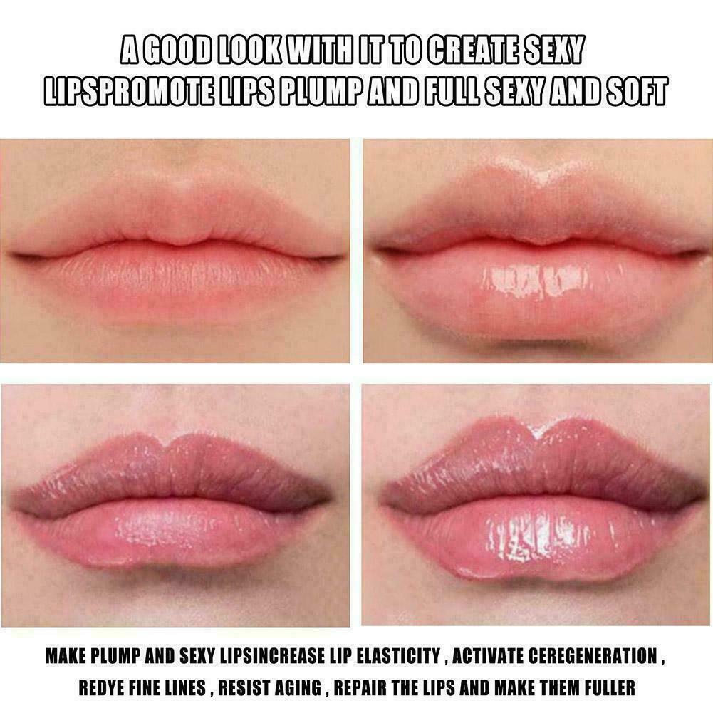 Octopus Shaped Nursing Lip Balm Moisturizing Fades Exfoliating Lip Lines T3S8