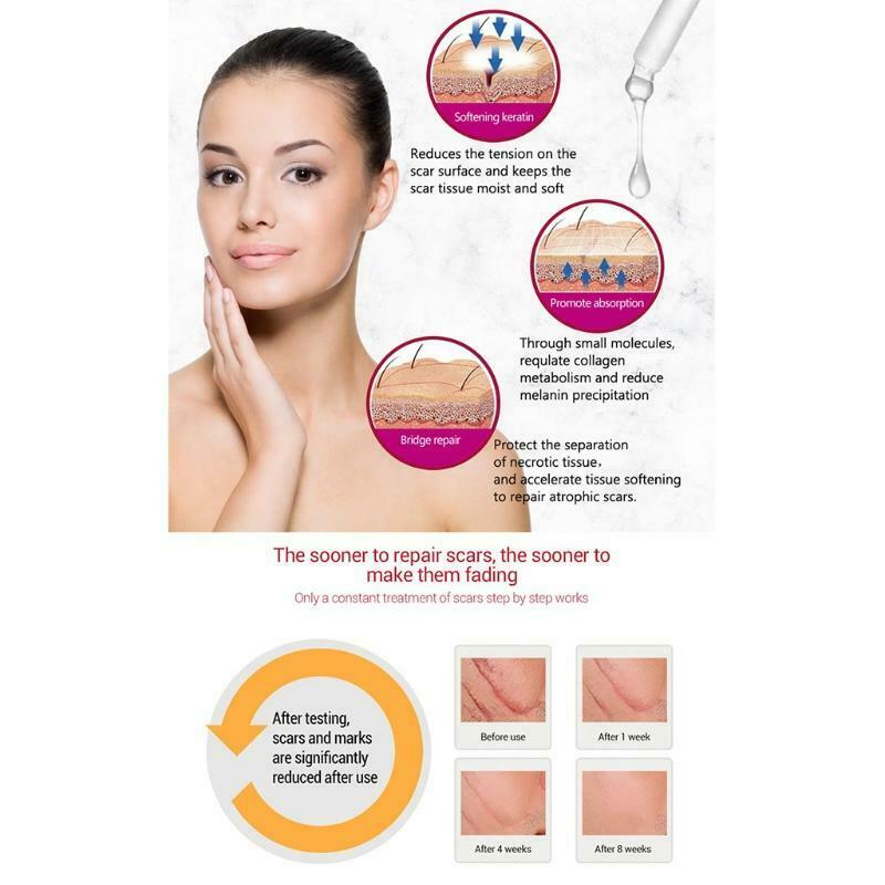 Scar Removal Whitetening Face Serum Scars Treatment Skin Repair for Face Acne
