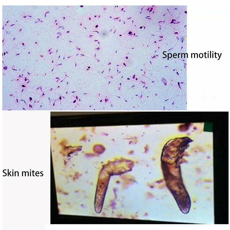 7″ Screen 40X-2000X Biological Microscope Sperm Locust Blood Test Microsocpe