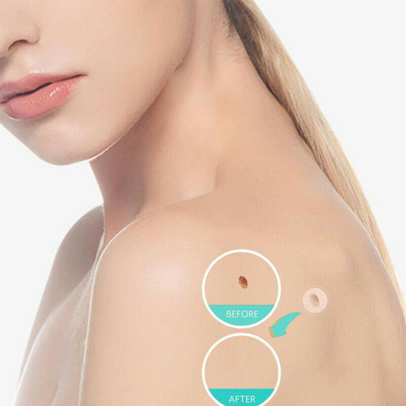 36PCS Fast Remover Pimple Patch Treatment Acne Patch Skin Tag Beauty Make.l8
