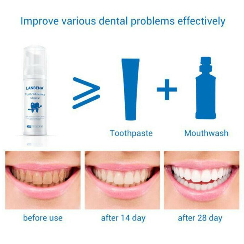 Teeth Whitening Foam Teeth Care for Home Use Maintain a Brighter Smile