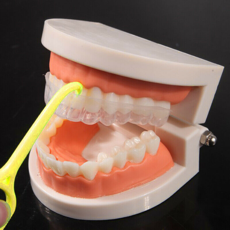 1Pcs Yellow Orthodontic Remover Removable Braces Clear Aligner Removal To.l8