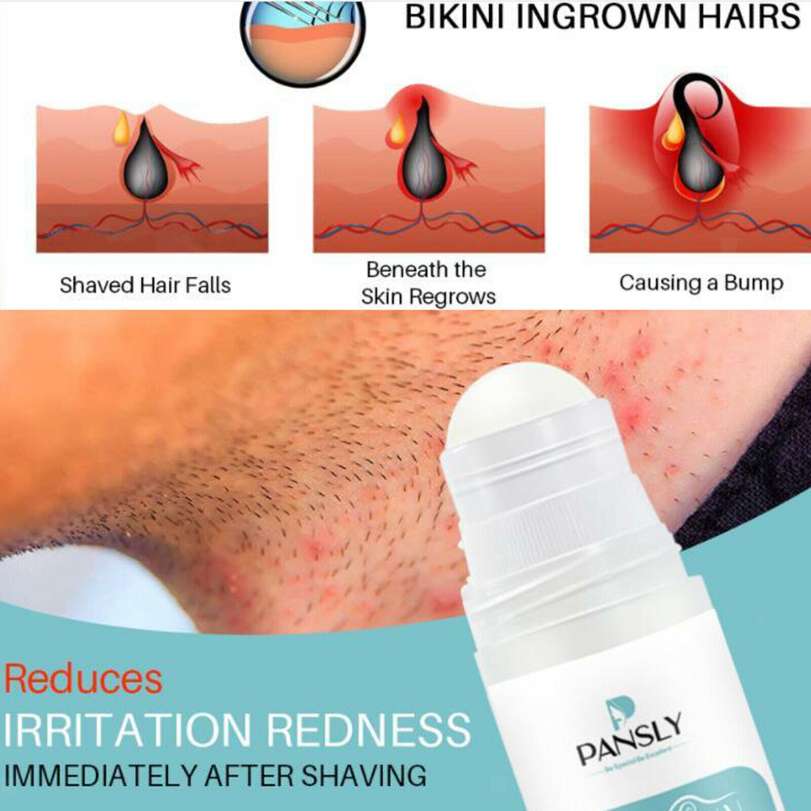 100ml 3.4 fl. oz 100% Natural Aftershave Serum for Razor Bumps Moisturizing