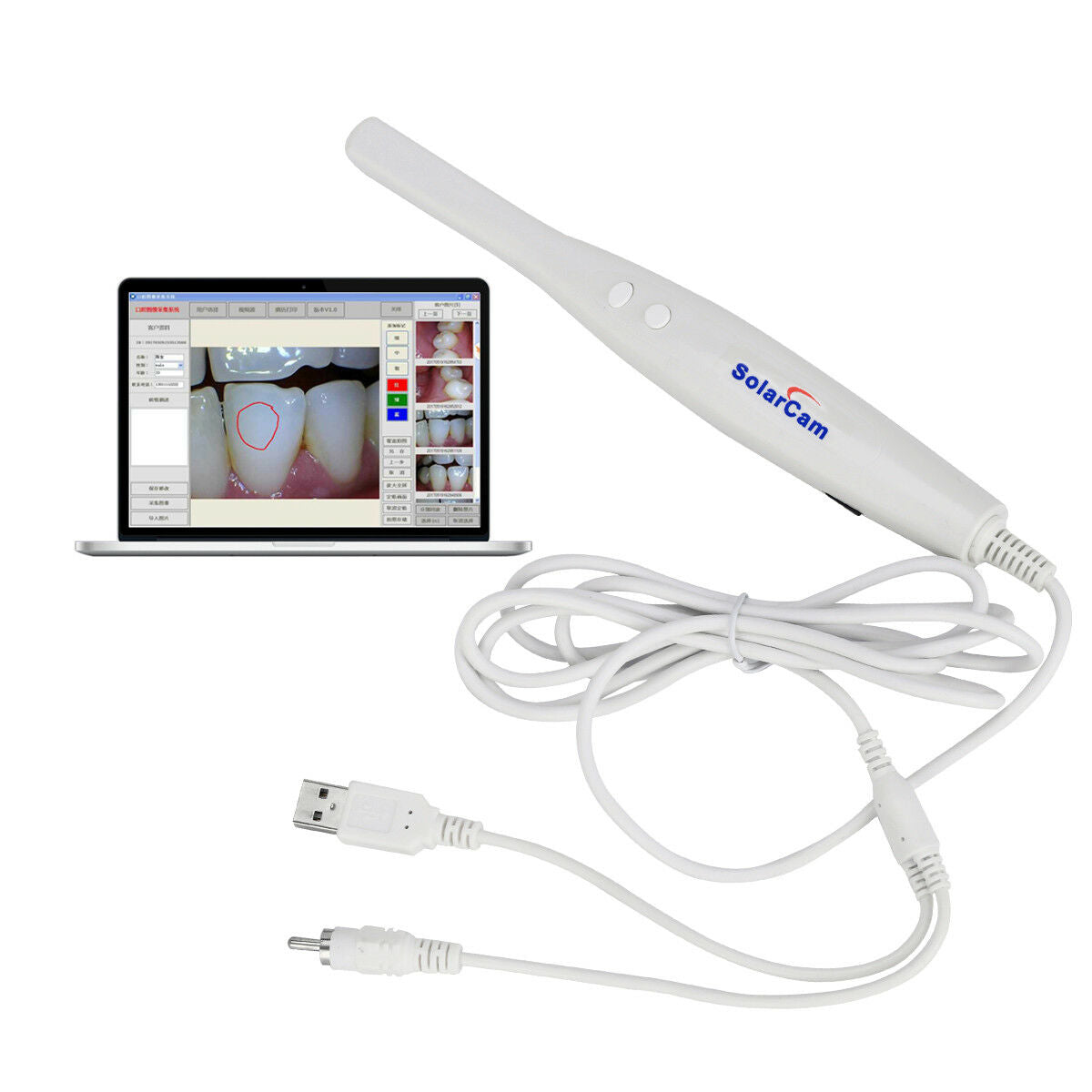 Solarcam Intraoral Camera Endoscope 4.0 Mega Pixels 8G Memory Card U801 PAL