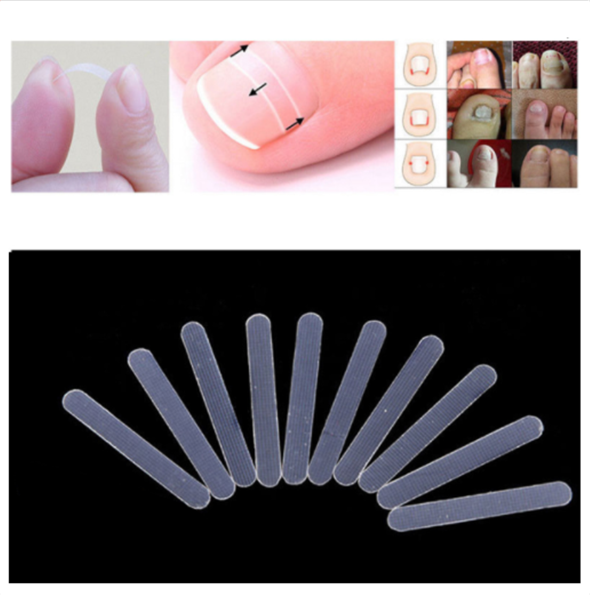 20pcs Ingrown Toenail Straightening Clip Curved Brace Treatment Tool With Glue