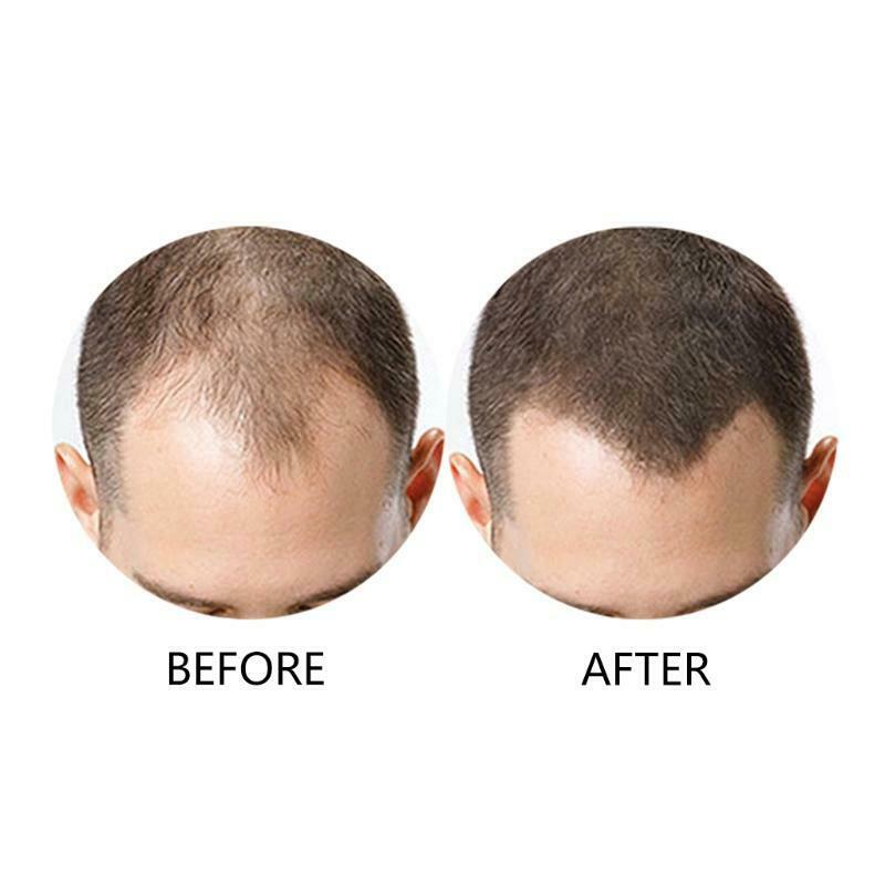Hair Building Fibers Powder Comb Hairdressing Top Hairline Optimizer Enhancer