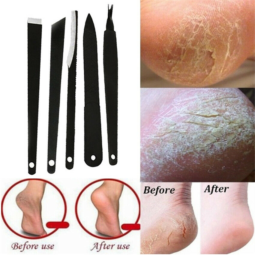 5pcs/set Nail Cuticle Pusher Remover Manicure Pedicure Stainless Steel Tool