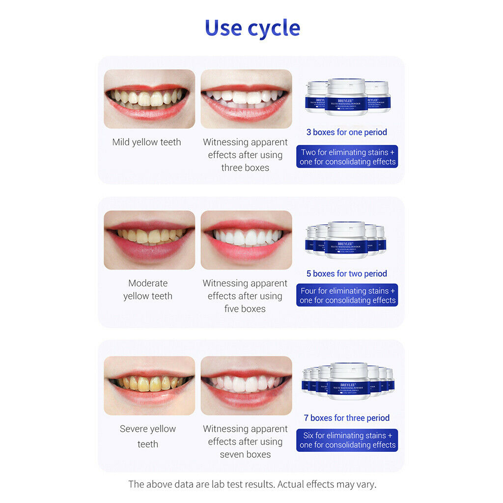 5pcs Teeth Whitening Powder Polish Tooth Supply Kit White Teeth Cleaning