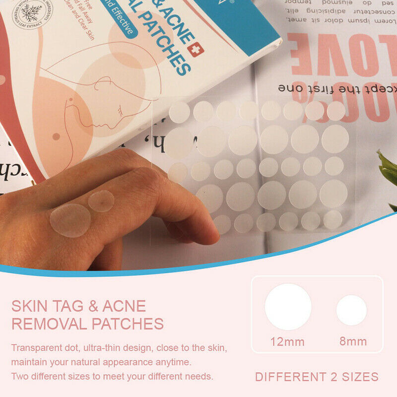108pcs Skin Tag Remover Patch Hydrocolloid Acne Pimples Moles Zits War.l8
