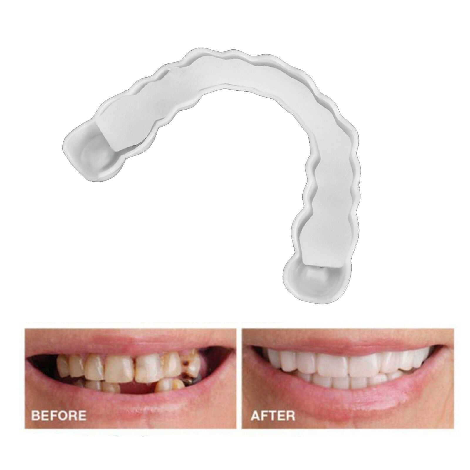 Smiling Snap Lower False Teeth Dental Veneers Dentures Tooth Cover White