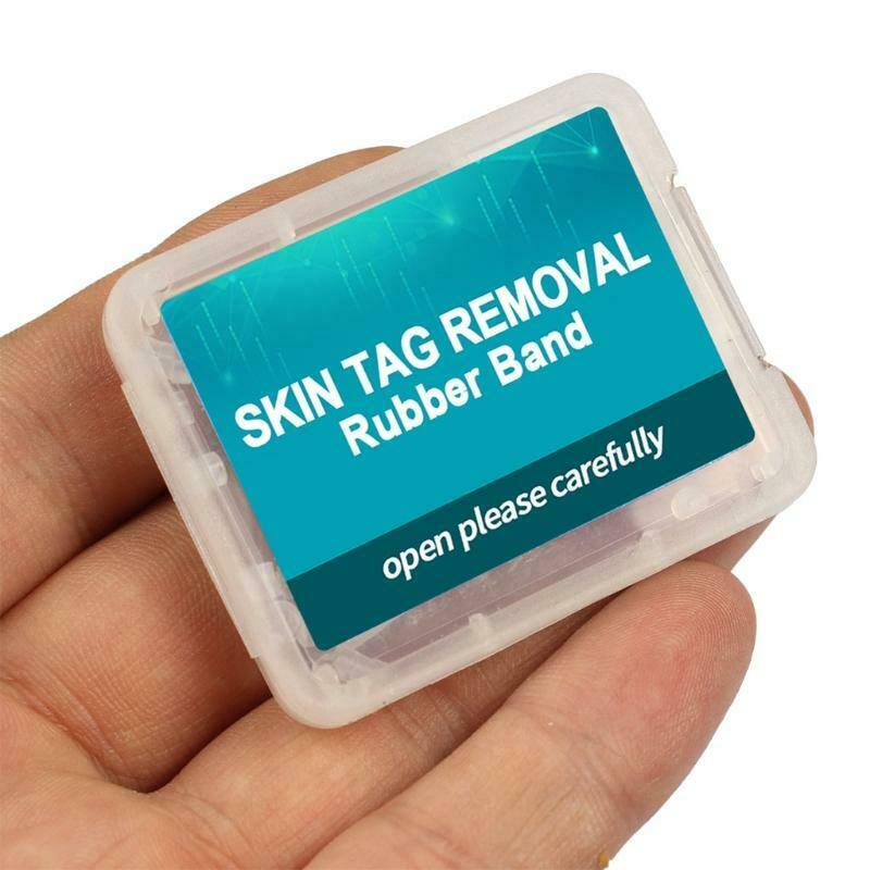 30Pcs Skin Tag Removal Rubber Bands Micro Band Non Toxic Face Skin Care