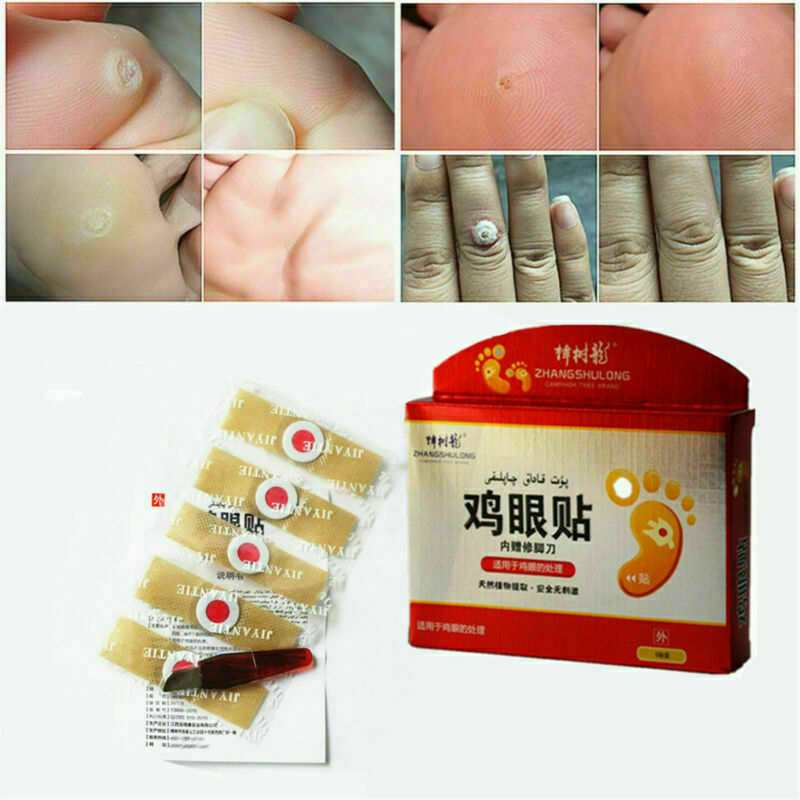 Foot Corn Removal Plaster Foot Pad Patch Dead Skin Callus Remover Relief