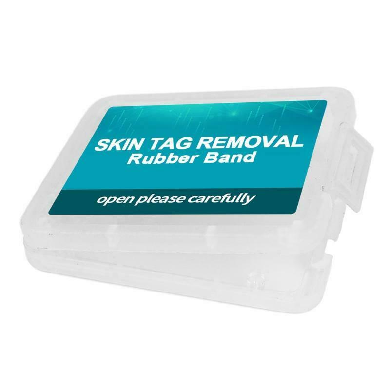 30Pcs Skin Tag Removal Rubber Bands Micro Band Non Toxic Face Skin Care