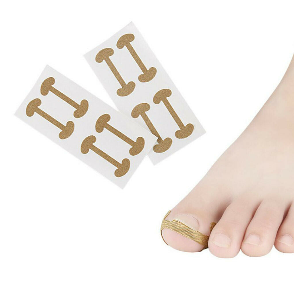 20 Pcs Ingrown Toe Nail Correction Stickers Fingernail Toes  Care