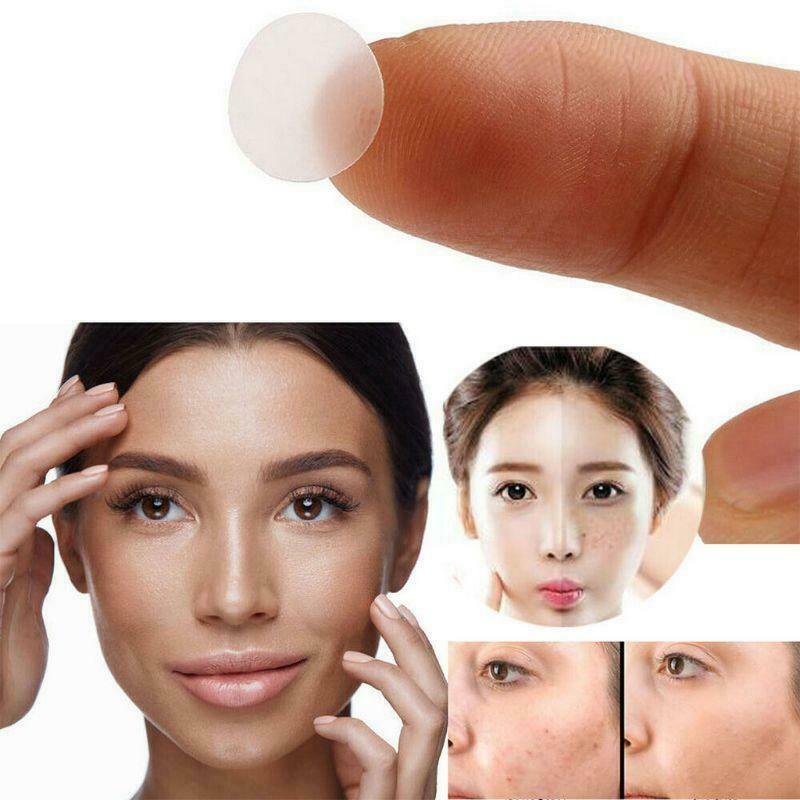 acne Pimple Patch, Hydrocolloid Acne Healing Patches, Invisible Absorbing Cover