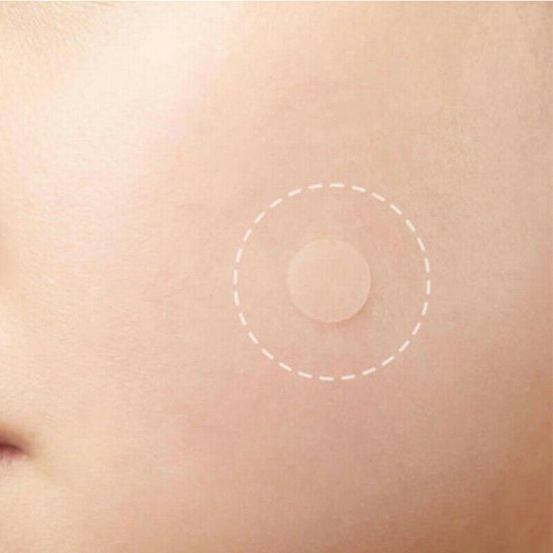 36PCS Fast Remover Pimple Patch Treatment Acne Patch Skin Tag Beauty Make.l8