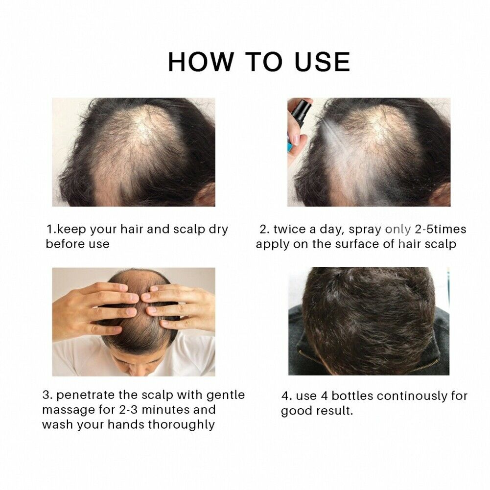 30ml Hair Growth Serum Hair Essence Nourishes, Softens and Repairs Damaged Hair