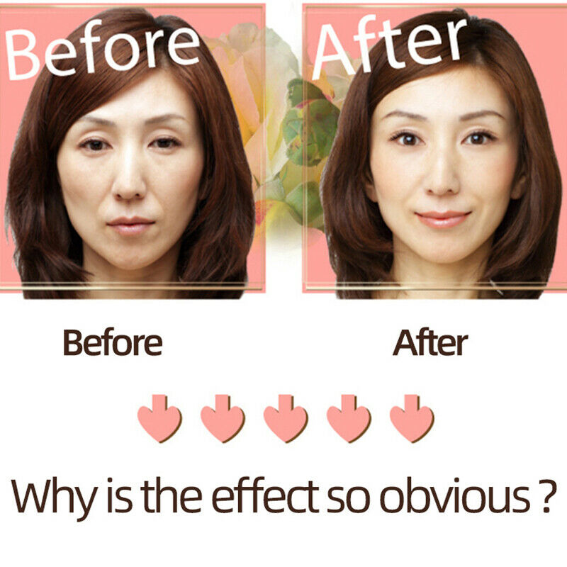 Invisible Bands to Remove Statute Lines Eye Bags Wrinkles Crow's feet HairpiFCA