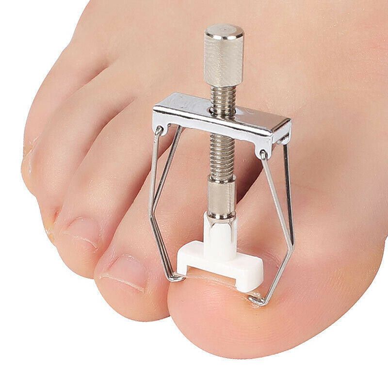 Ingrown Nail Recover Correction Pedicure Toenail Fixer Care Tool Nail CorrecFCA