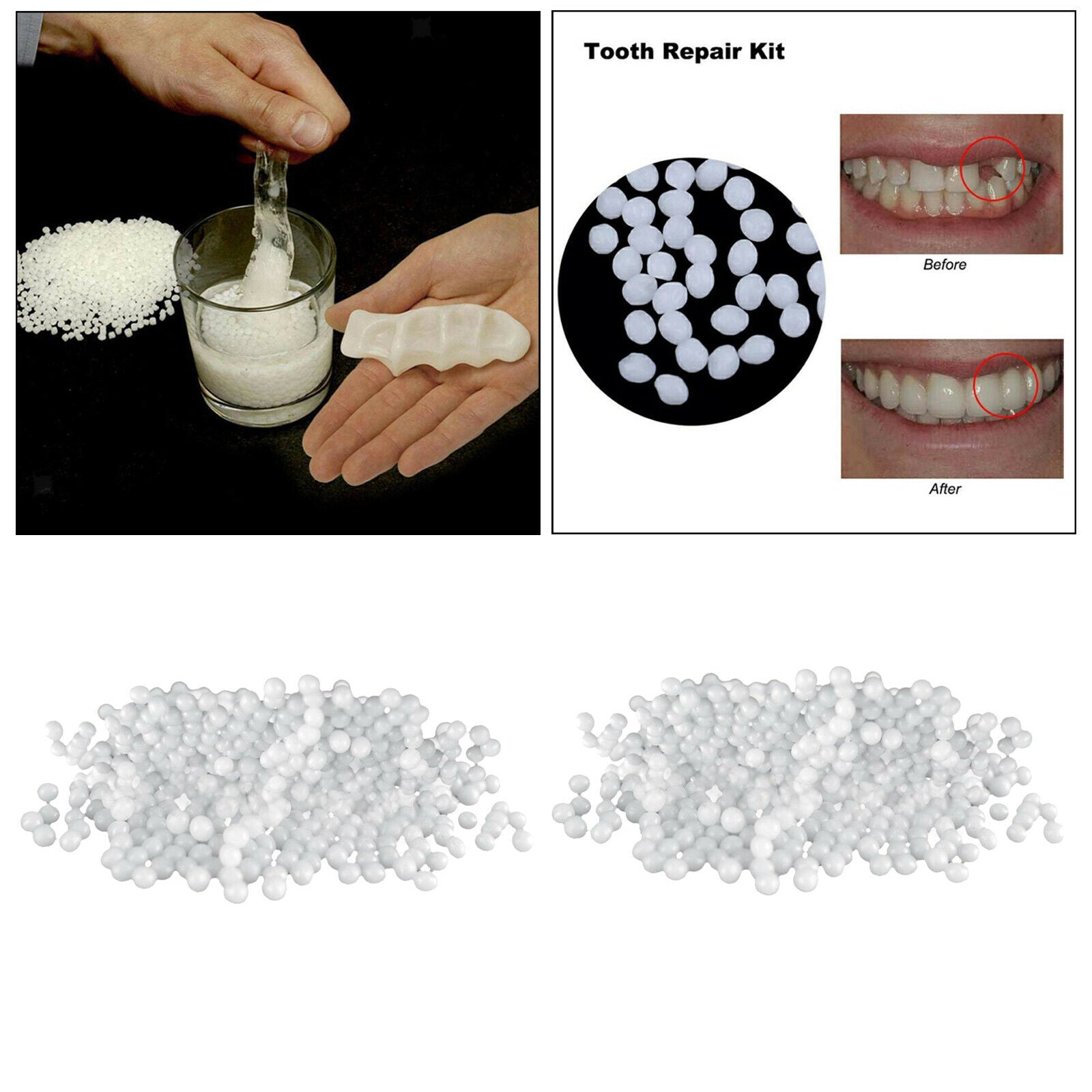 Dental Thermal Beads 150g Denture Temporary Teeth Repair Thermal Beads