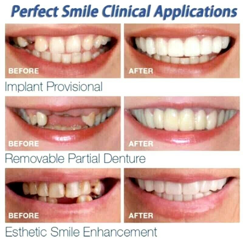 Magic Teeth Brace Temporary Smile Comfort Fit Cosmetic Denture Teeth Dent