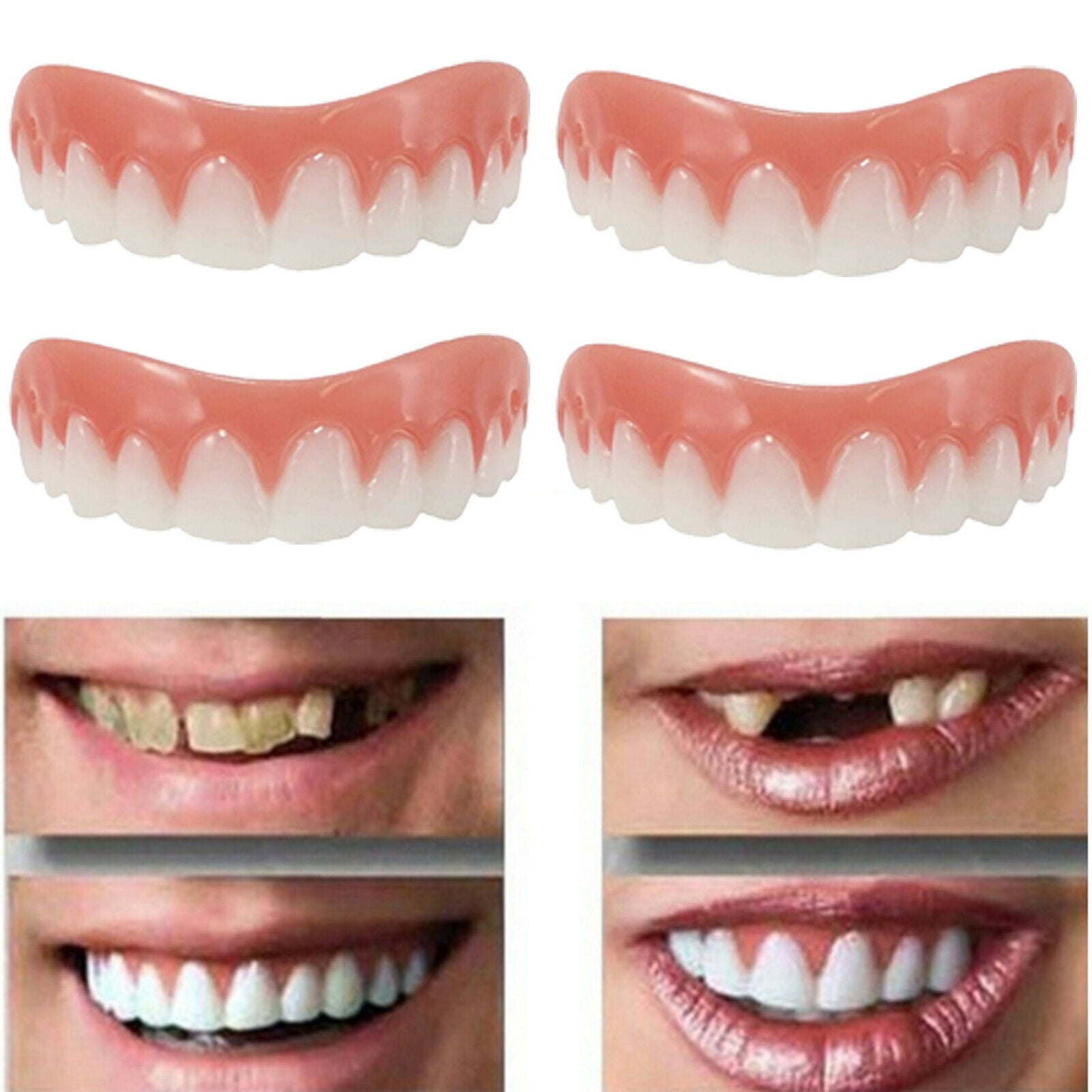 Professional Cosmetic Upper Teeth - New from Instant Smiling! Hand Crafted