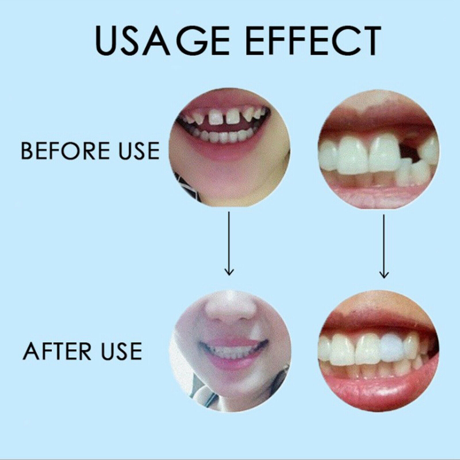 Thermal Beads Teeth Veneer Moldable Denture Temporary Tooth Repair Tools 5g