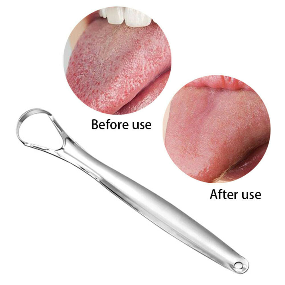 1 pc Stainless Tongue Tounge Cleaner Scraper Dental Care Oral Hygiene Mouth Kit