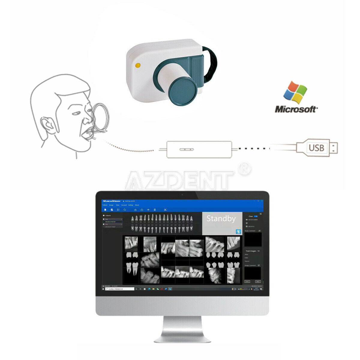 Woodpecker i-Sensor Style Dental Intraoral X-ray Digital RVG Sensor Adlut Child