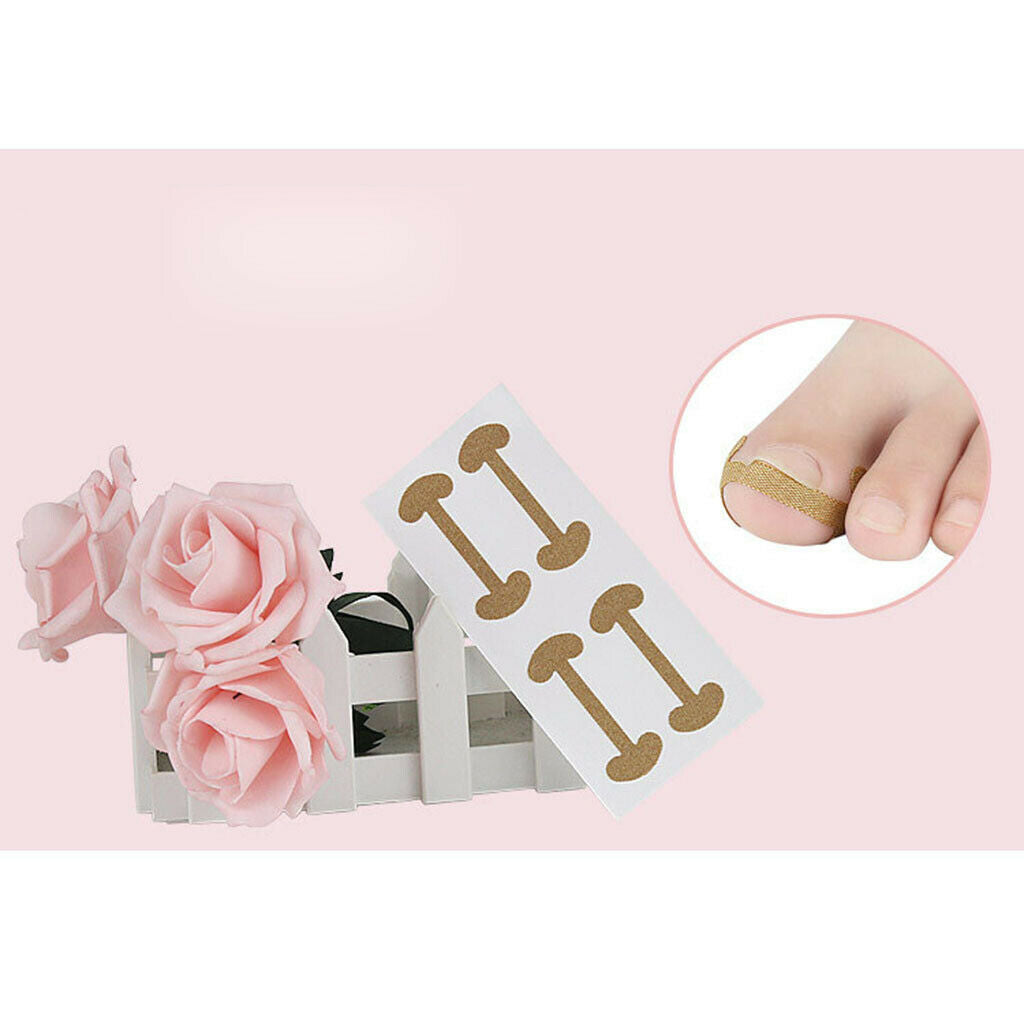 20 Pcs Ingrown Toe Nail Correction Stickers Fingernail Toes  Care