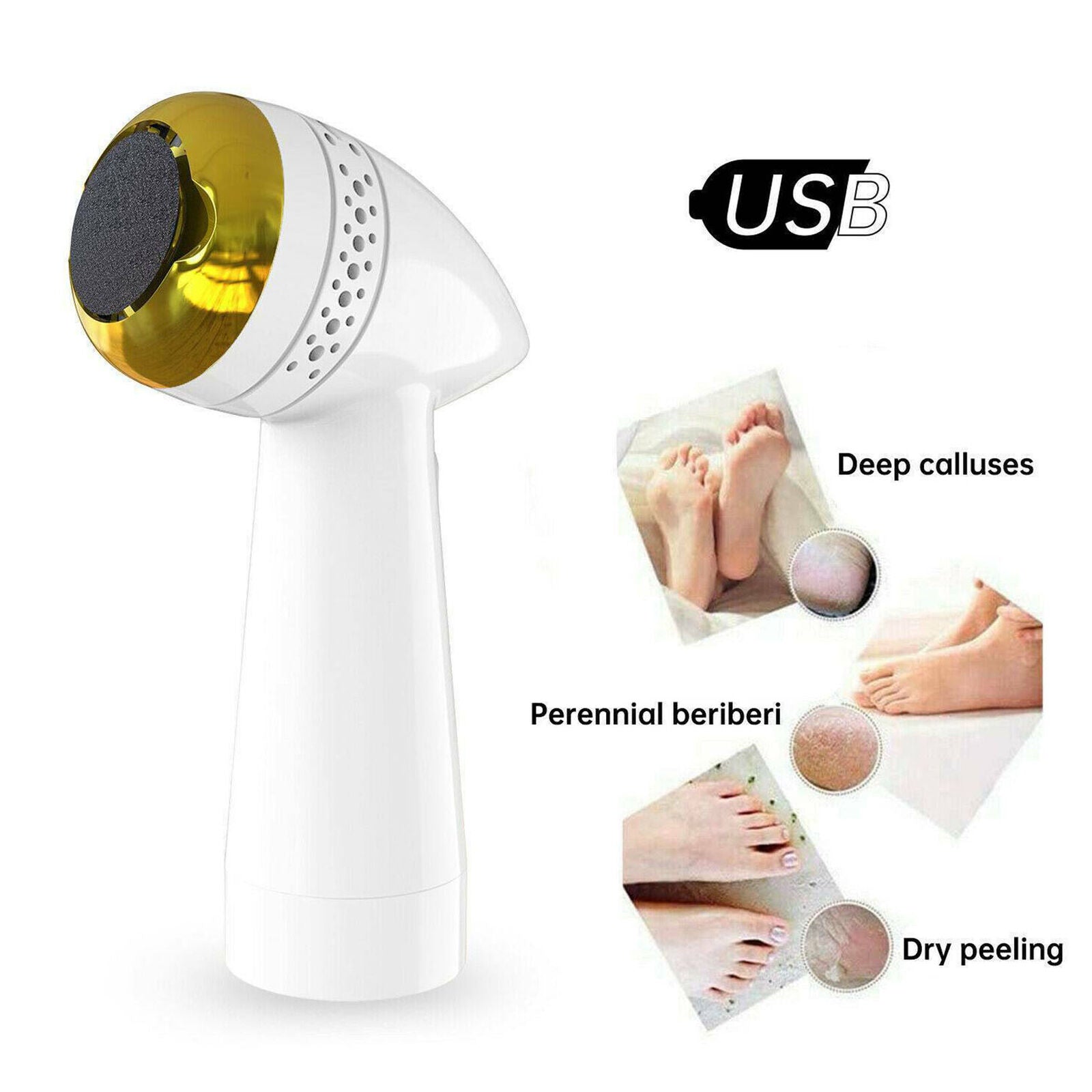 Electric Vacuum Foot Grinder File Dead Skin Callus Remover Exfoliate Adsorption