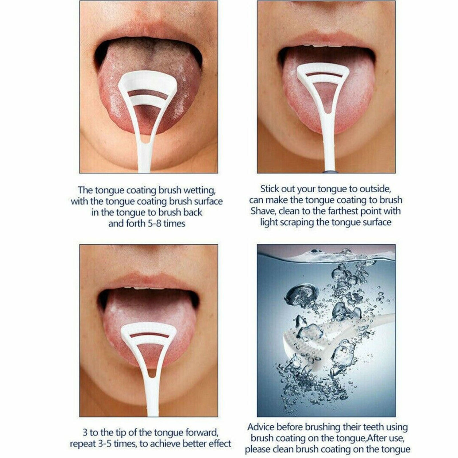Tooth Polishing Cleaner Ultrasonic LED Electric Oral Teeth Cleaning Kit + 5 Tips