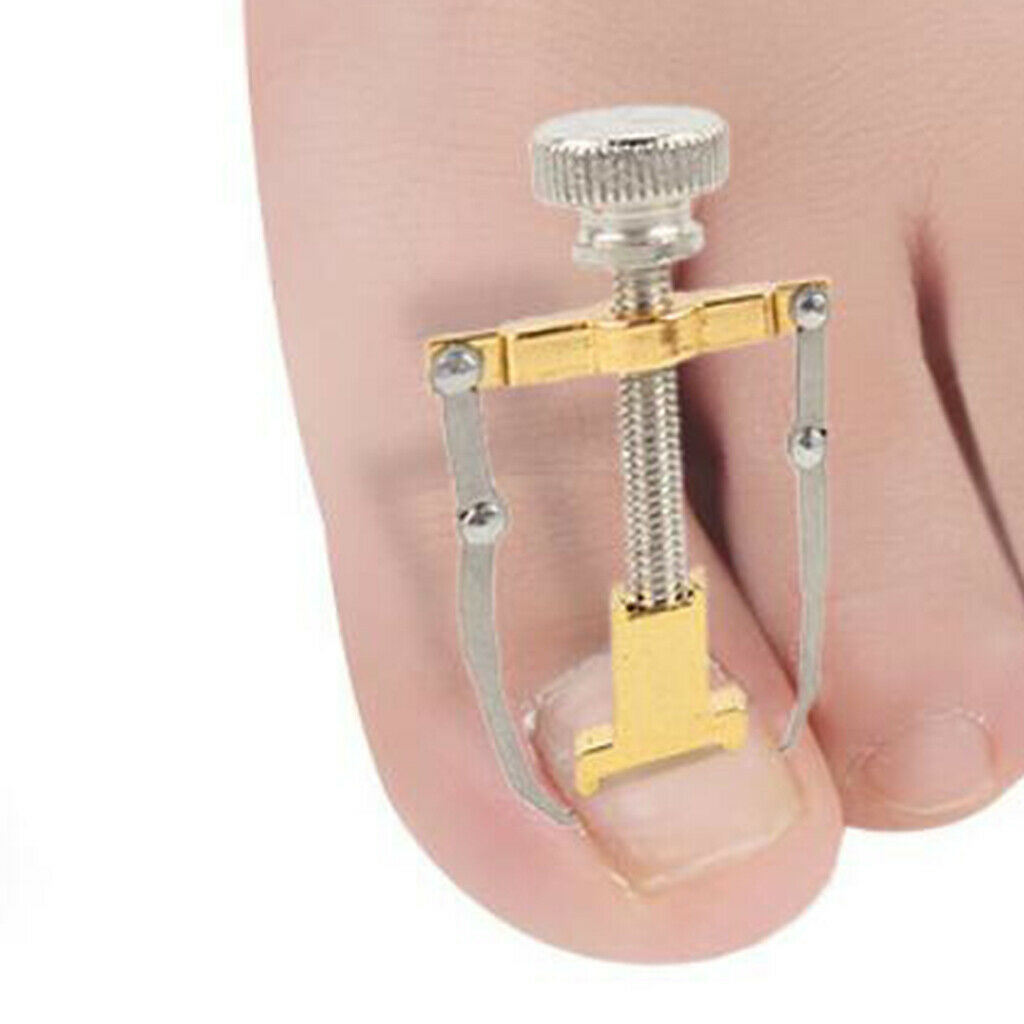 2 Pieces Alloy Ingrown Toenail Correction Lifter Toenail Straightener Tool