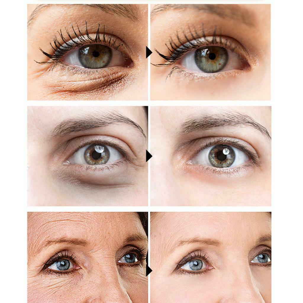 Precious Eye Essence Repair Synchronized Instant Firming Eye Under Eye 10ml