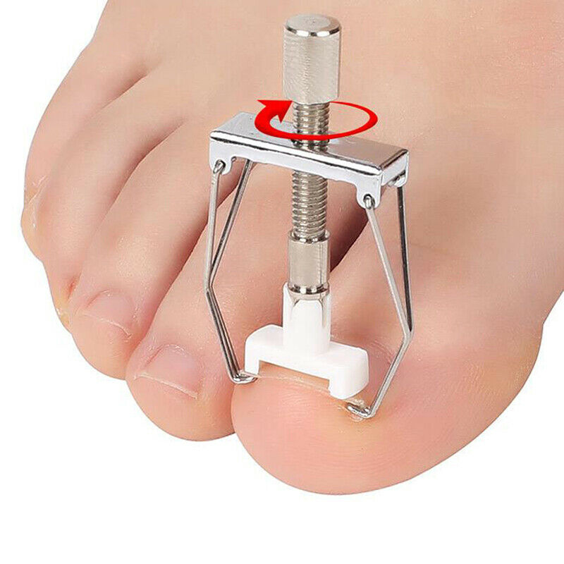 Ingrown Nail Recover Correction Pedicure Toenail Fixer Care Tool Nail CorrecFCA