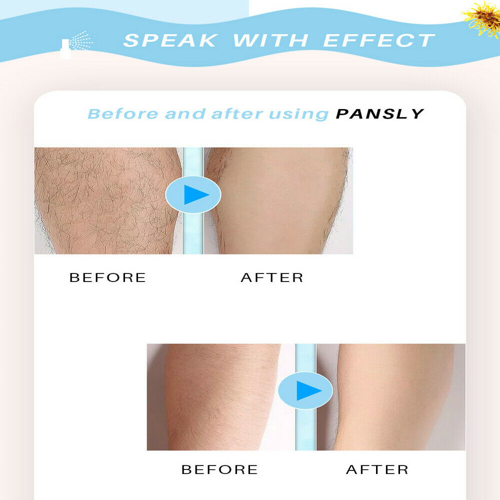 Mild Inhibition Hair Growth Wax Treatment Spray Liquid Hair Removal Sprayer HOT