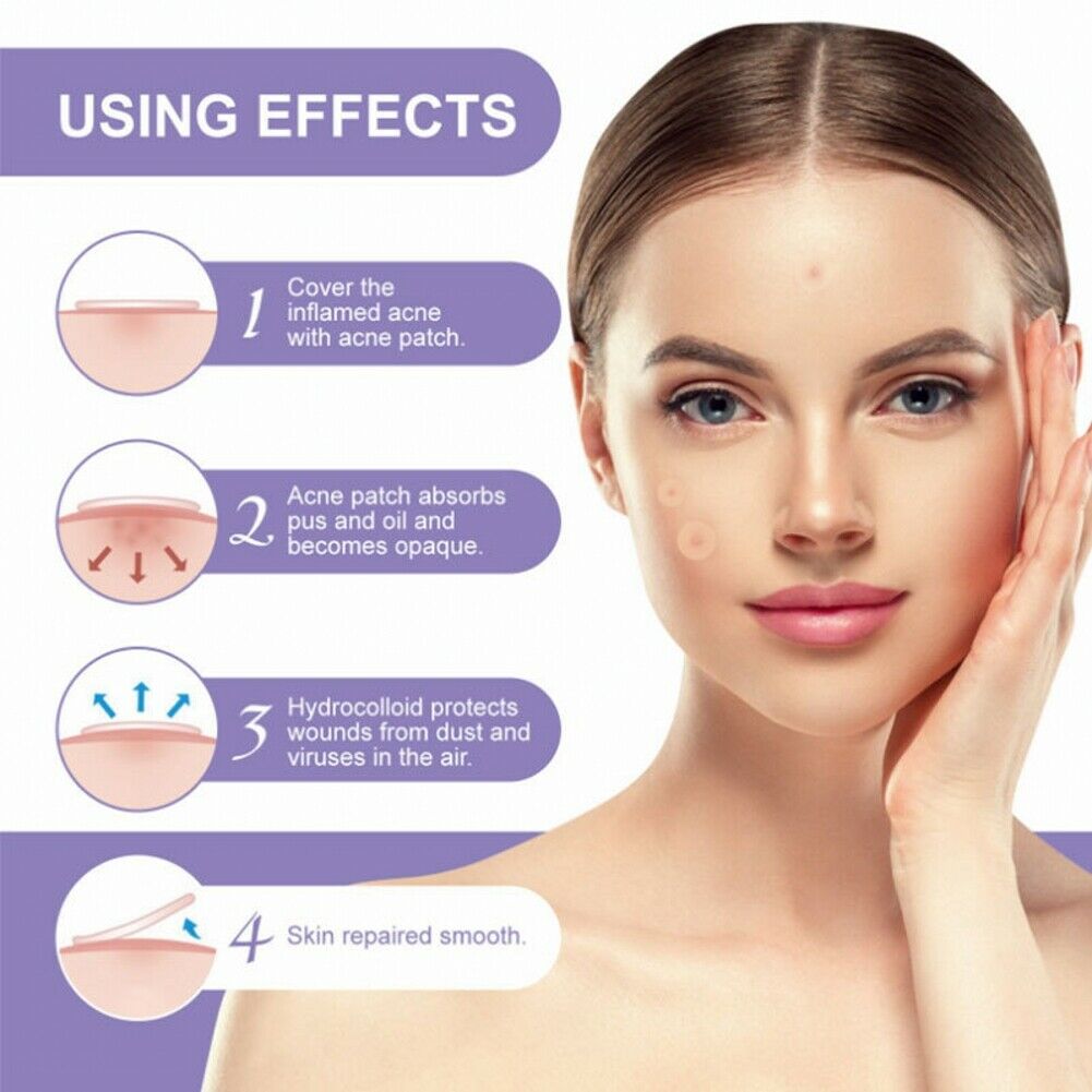 24Pcs/Sheet Invisible Acne Patches Anti-Acne Colloidal Acne-Covering Patch
