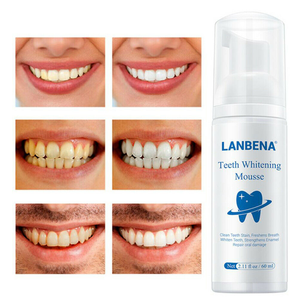 Daily Teeth Whitening Whiten Foam for Home Use Maintain a Brighter