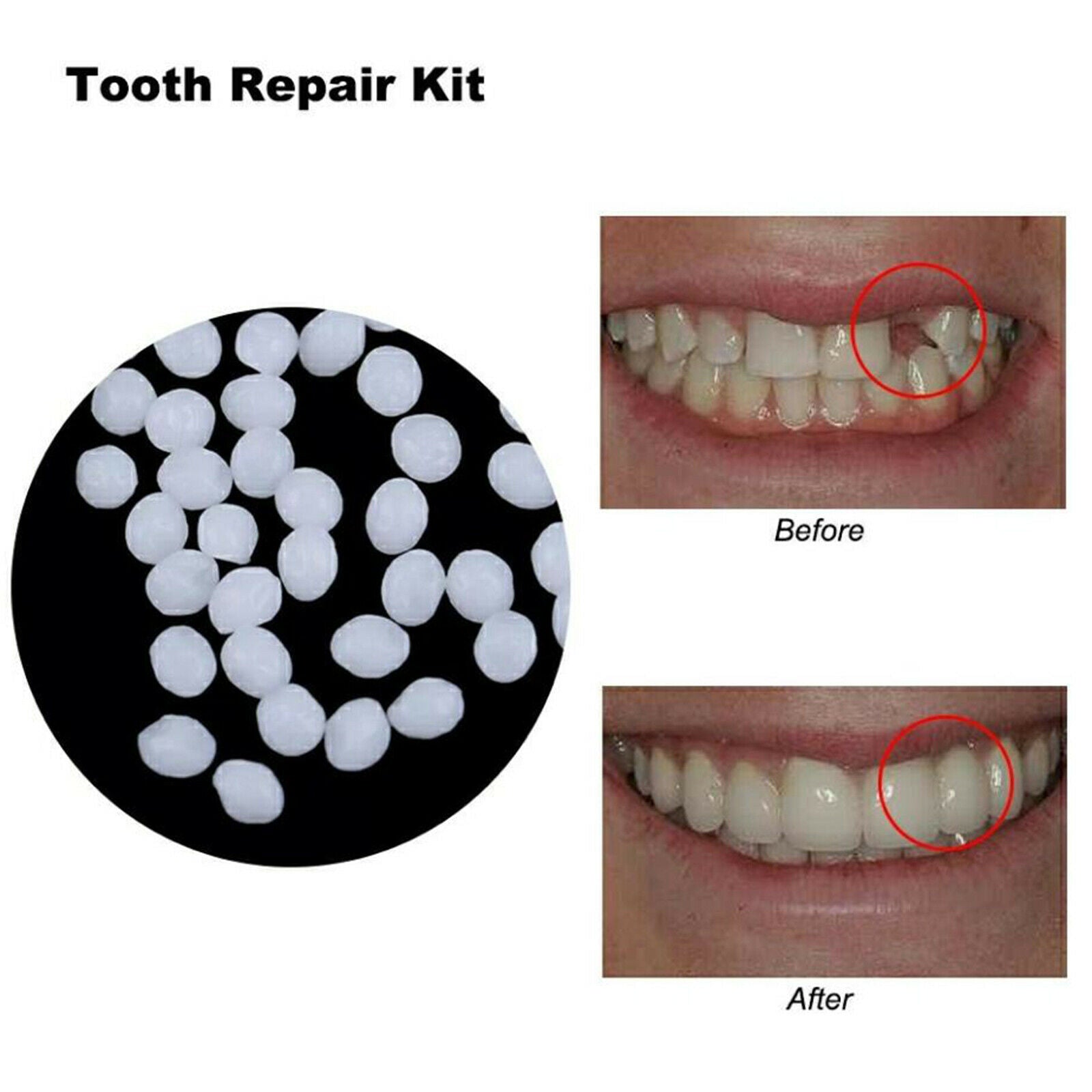3X Thermal Beads Teeth Veneers Moldable Temporary Tooth Repair Beads 100g