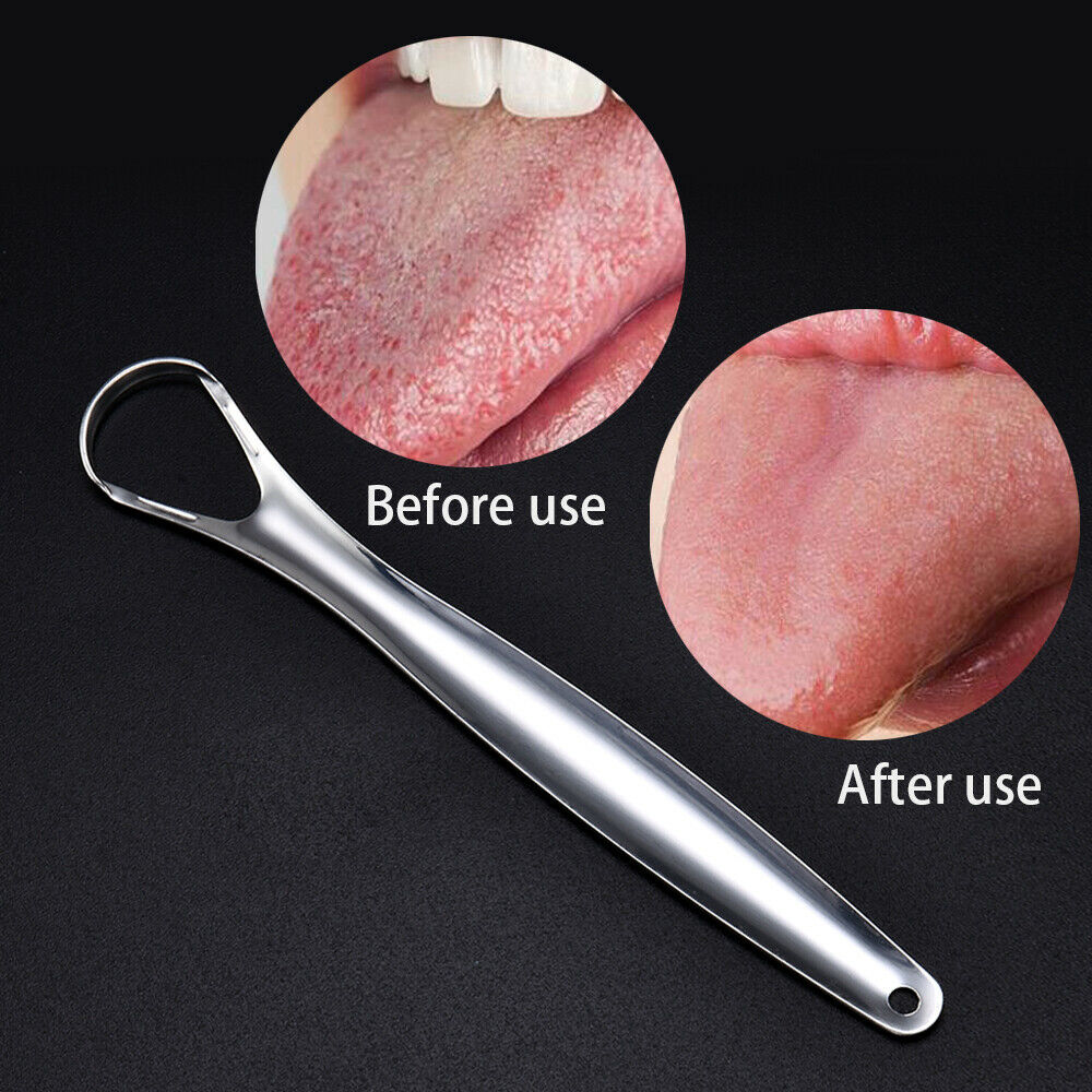 Useful Stainless Steel Tongue Cleaner Scraper Oral Care Fresh Breath Maker Tool