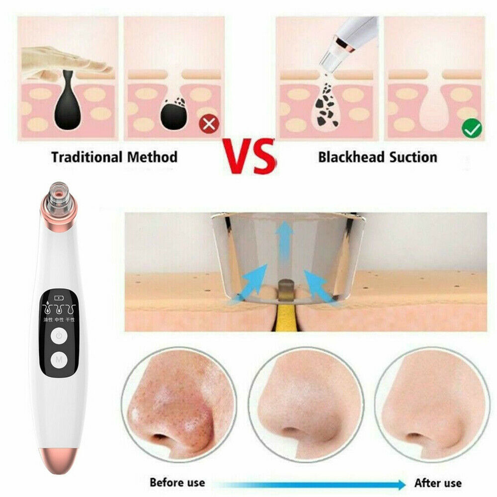 Visible Electric Blackhead Remover with Camera Derma Vacuum Pore Cleaner Suction