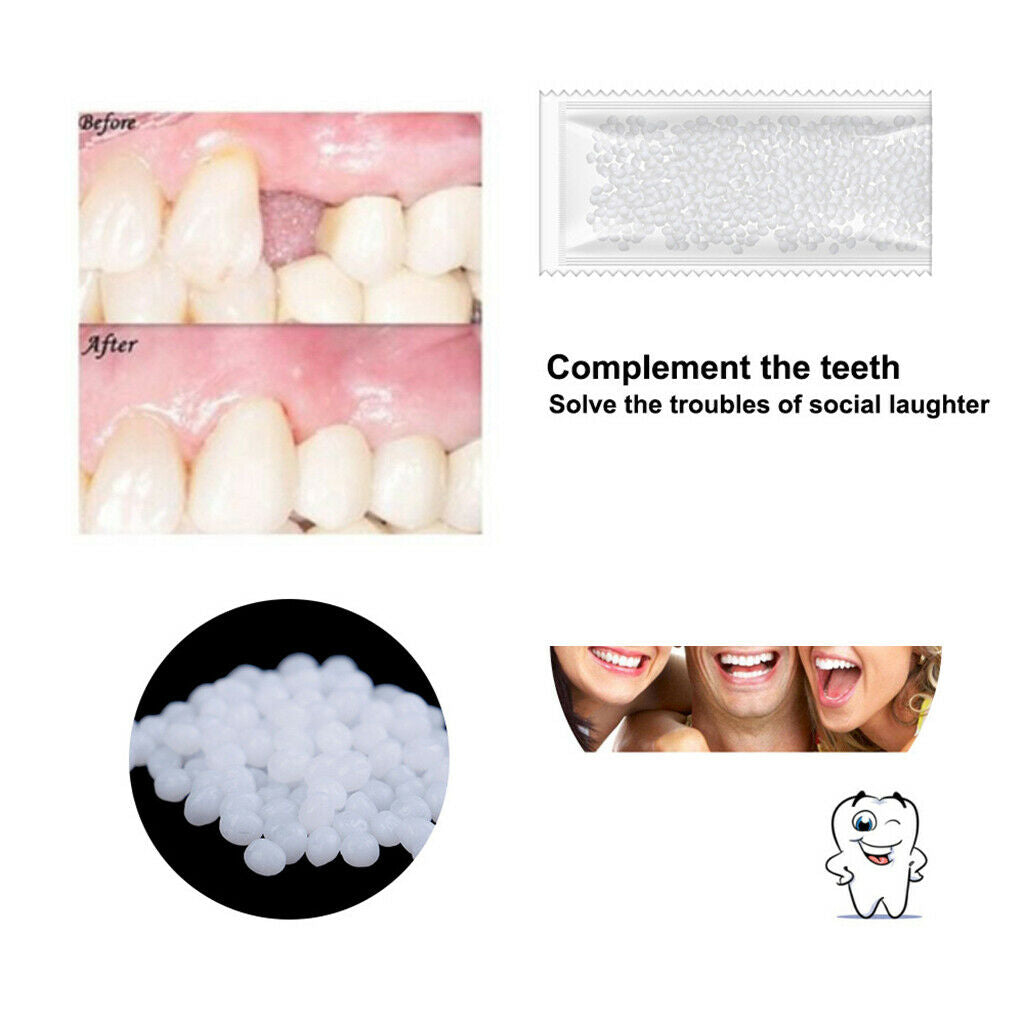 Kit Teeth Stickers Teeth Whitening Pen Teether Whitening Suit Remove Yellow