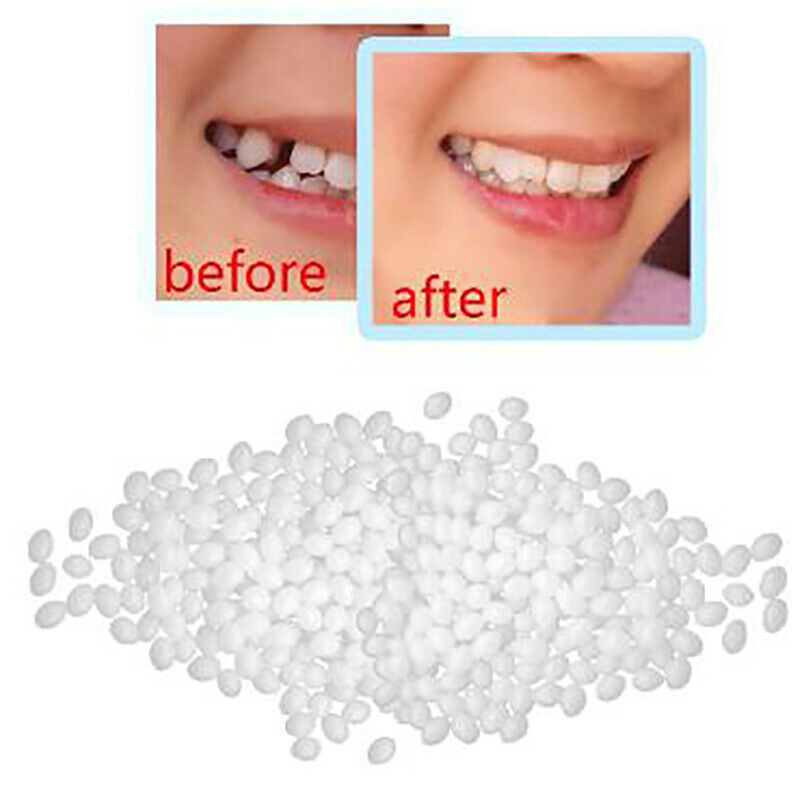 1Denture Solid Glue Dental Restoration Temporary Tooth Repair Kit Teeth A.l8