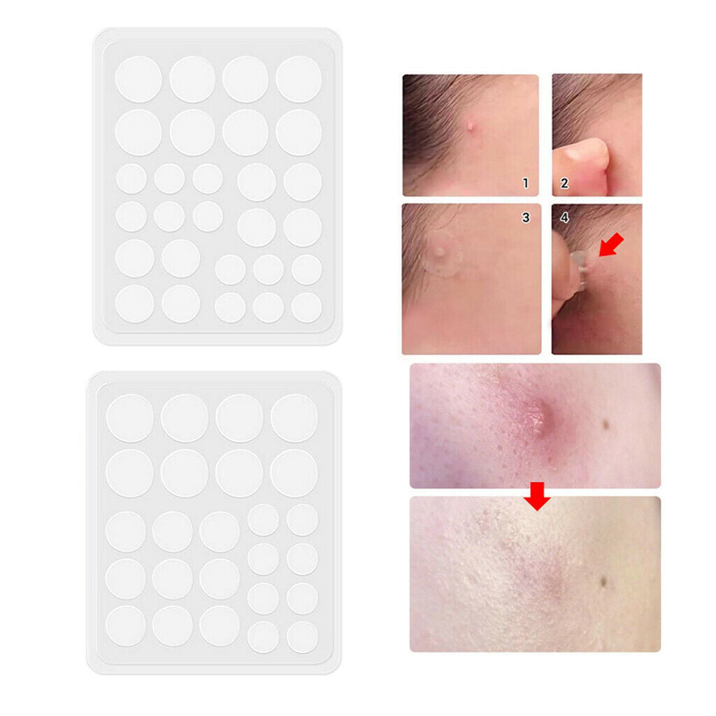 53 Pieces Hydrocolloid Acne Stickers Transparent Facial Spot Face Skin Care