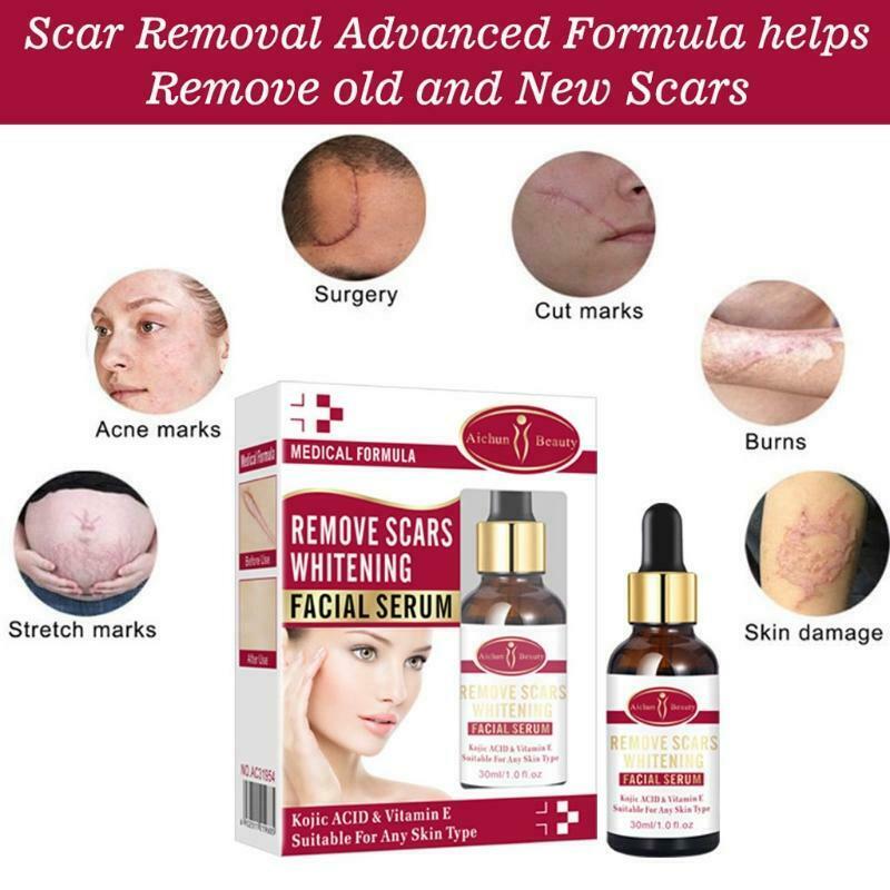 Scar Removal Whitetening Face Serum Scars Treatment Skin Repair for Face Acne