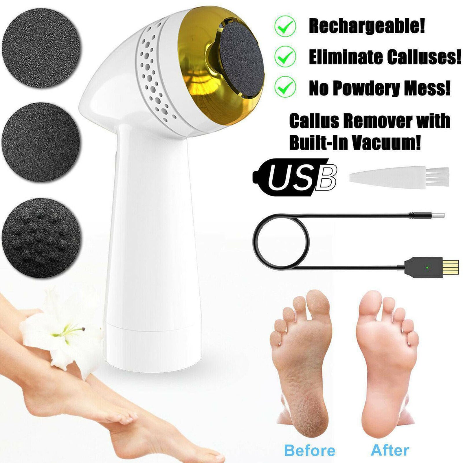 Electric Vacuum Foot Grinder File Dead Skin Callus Remover Exfoliate Adsorption