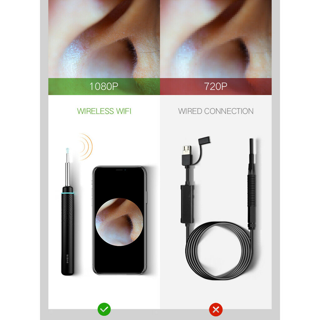 Bebird M9 Pro Visual Ear Stick Endoscope 300W Otoscope Borescope Ear Picker