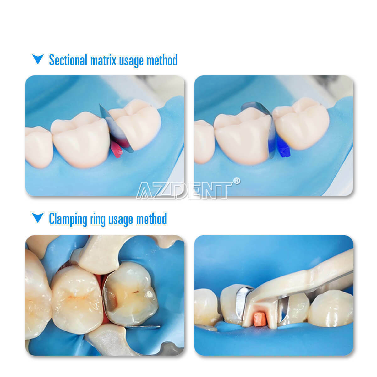 Dental Sectional Contoured Metal Matrices Matrix Refill F2 Matrix Bands AZDENT
