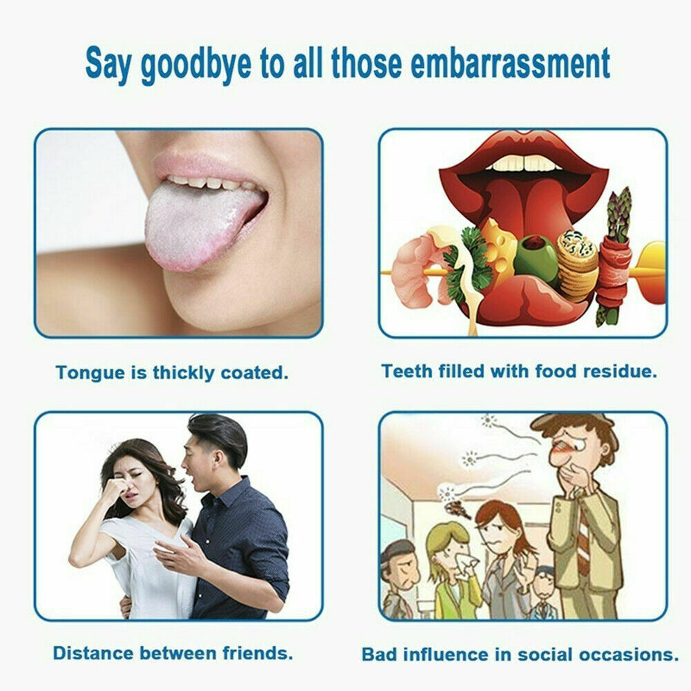 Stainless Steel Tongue Scraper Cleaner Bad Breath Sweeper Oral Fresher Hygiene_