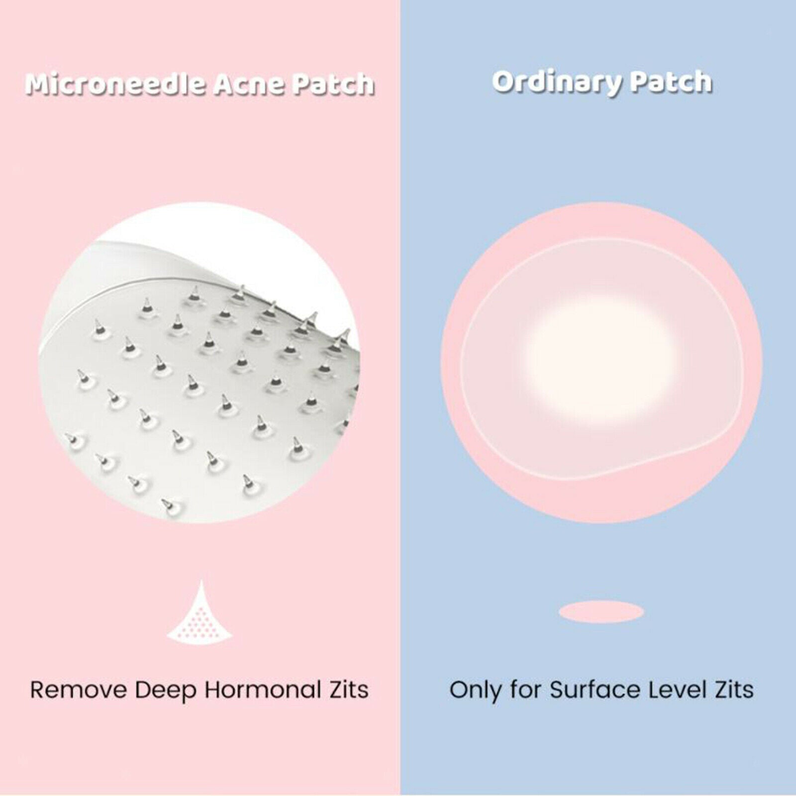Acne Patch Blemish Spot 9 Count for Microcrystal Face Skin ,